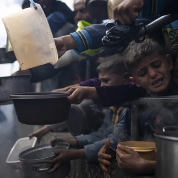 Gazze’de çocukları öldüren sadece İsrail bombaları değil. Şimdi bazıları açlıktan da ölüyor